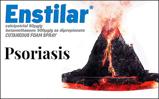 FD25042_Enstilar_320x200_MREC_D3_Frames (2) (1) (1)